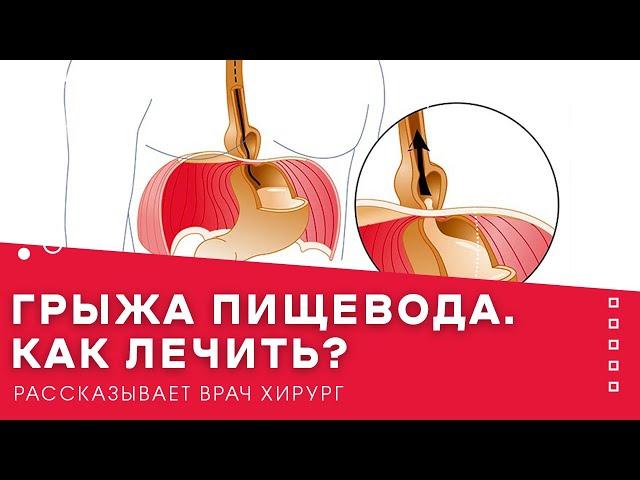 Грыжа пищевода. Как лечить?