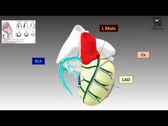 Coronary Artery Anatomy