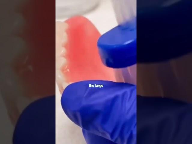 How to Clean Your Dentures the Right Way | Aspen Dental Care Tips