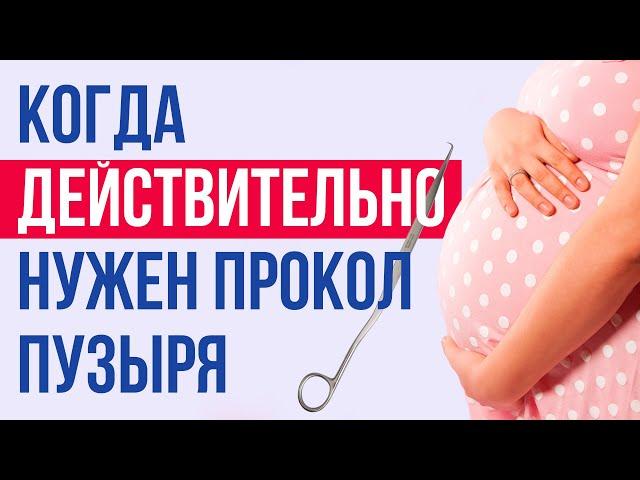 Прокол пузыря: акушерская агрессия или необходимость?