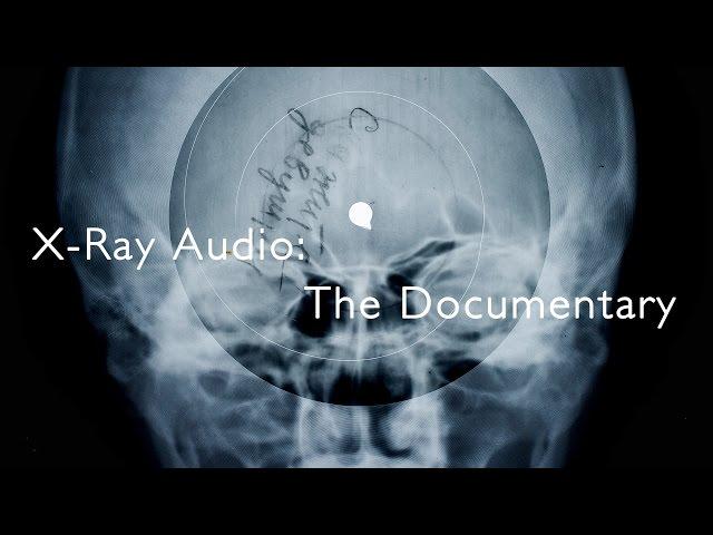 X-Ray Audio: The Documentary