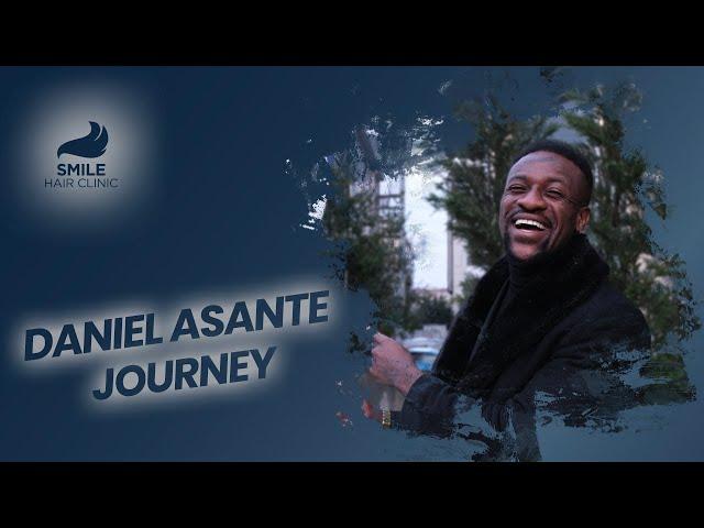 Daniel Asante’s Hair Treatment Journey | Fashion Model’s Experience with Dr. Mehmet Erdoğan