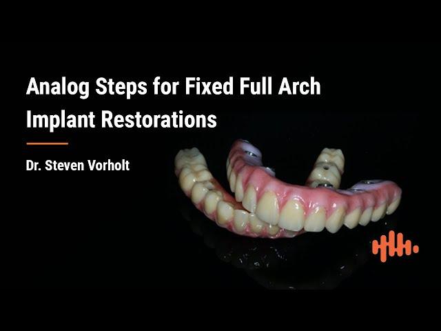 Analog Fixed Full Arch Restoration Steps - Dr. Steven Vorholt