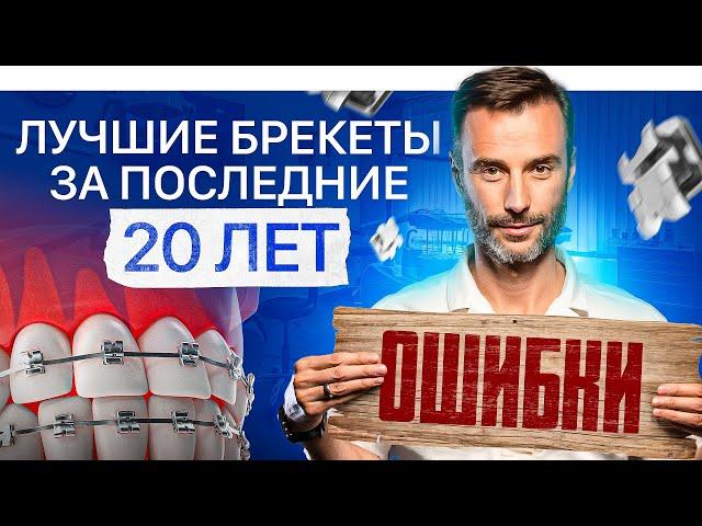 Какие брекеты выбрать? Ошибки при выборе брекетов