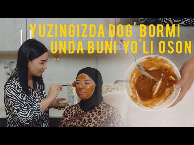 Yuzingizdda dog' bormi? Unda juda osson usuli Odina Tuxtasinovadan