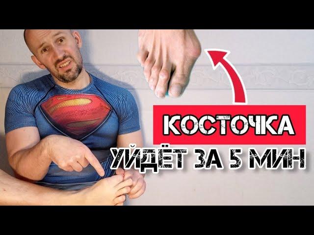 "Косточка" на большом пальце ноги уйдёт за 5 минут навсегда