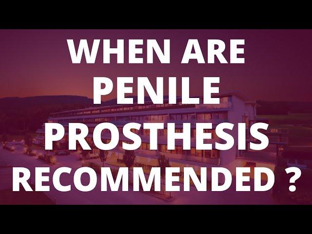 Penile Prosthesis: When are they considered a good option?