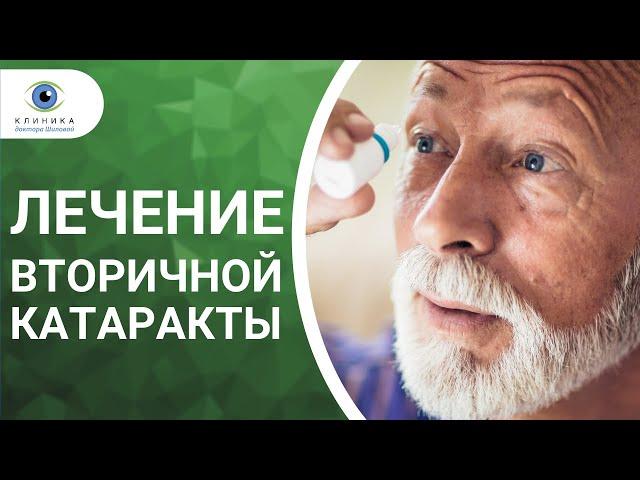 Вторичная катаракта после замены хрусталика - лечение