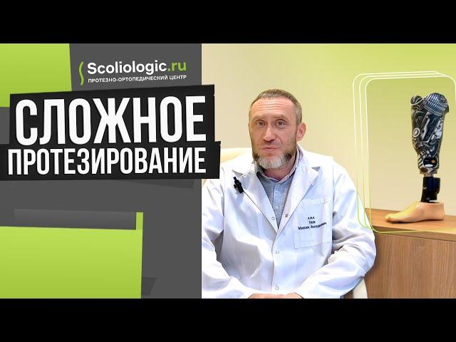 Сложное протезирование нижних конечностей