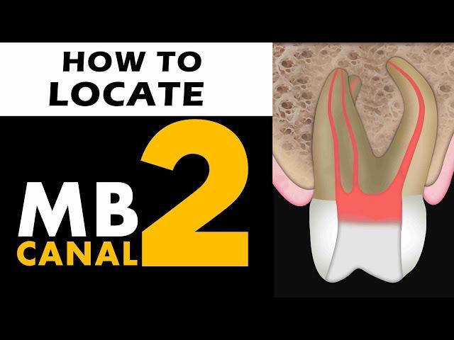 MB2 Canal location | Easy techniques