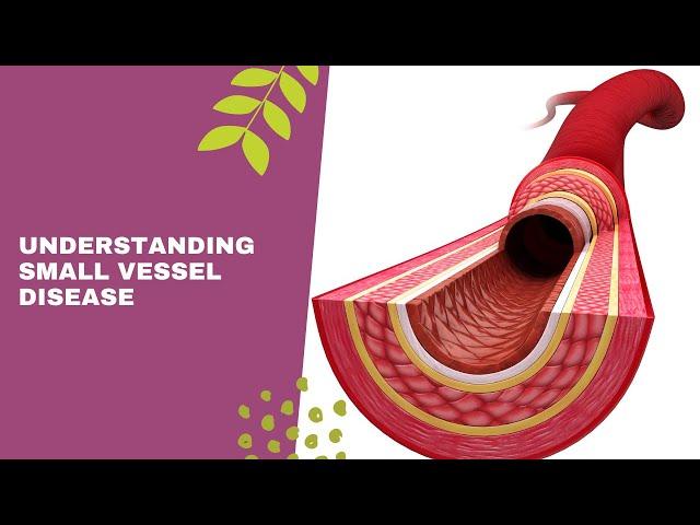 Understanding Small Vessel Disease