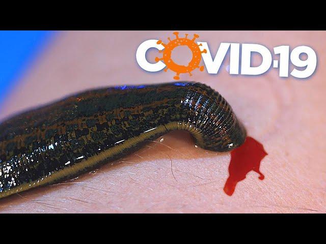 WHAT IF A LEECH IS DRINKED WITH THE BLOOD OF A COVID-19 Patient