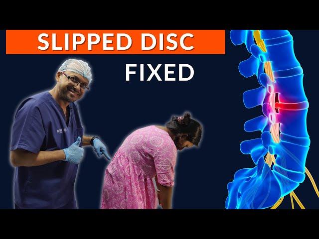 RECOVERY of SLIPPED DISC | Best Chiropractor in INDIA | Dr Sanjay Sarkar