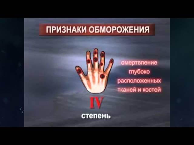 Утренний эфир / Степени обморожения