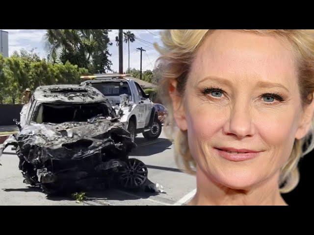 Very Sad News. Confirmed Life Support Switched Off: Actress Anne Heche Has been Confirmed...