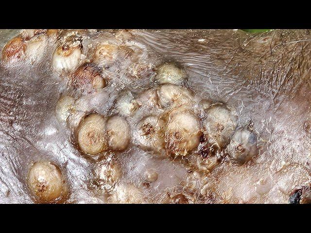Amos Obukanga's FAT JIGGERS REMOVAL #2-  subscribe @riseupsociety.net for long video & 1000s more