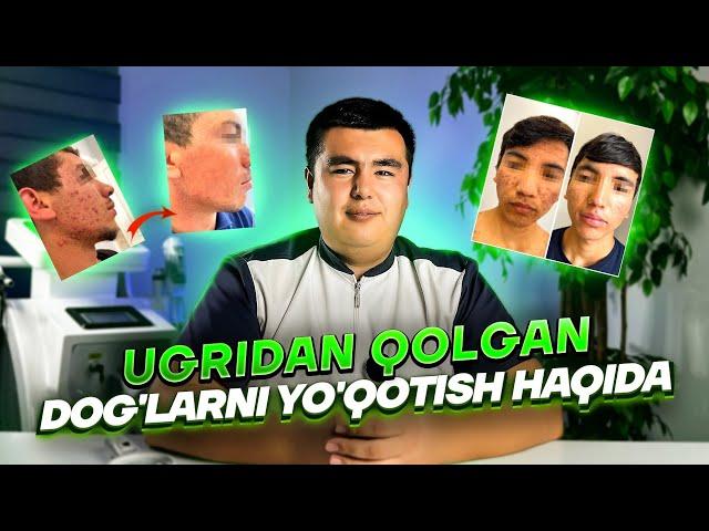 UGRIDAN QOLGAN IZLARNI VA CHANDIQLARNI DAVOLASH, UNDAN QANDAY QILIB QUTILSA BO'LADI