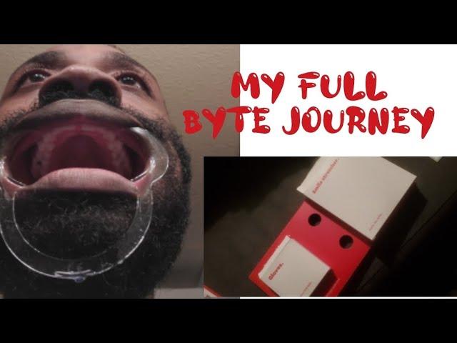 My Byte Journey |The FULL EXPIRENCE | A Keep it 100 Review #aligners #invisalign  #teeth