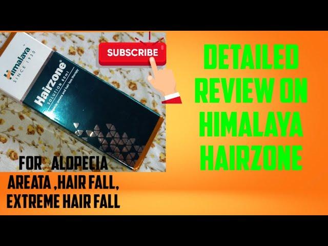 Review on Himalaya Hairzon solution for Alopecia areata, Pattern Hairloss.My vlogs by Saanvi.