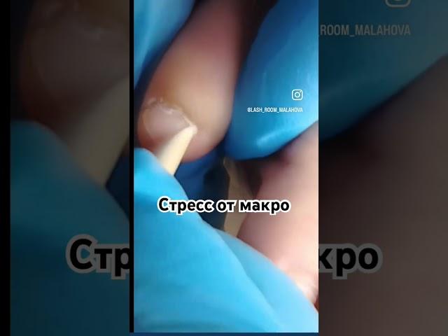 Стресс от макро линзы 🫣