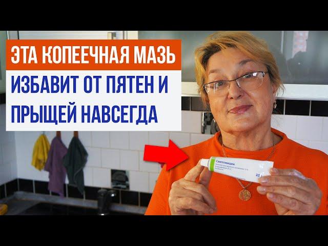 Копеечная мазь избавит от ПИГМЕНТАЦИИ и ПРЫЩЕЙ навсегда