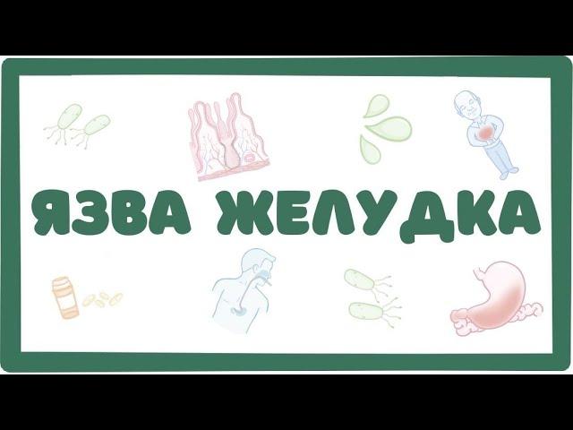 Язвенная болезнь желудка - причины, симптомы (лекция) Osmosis