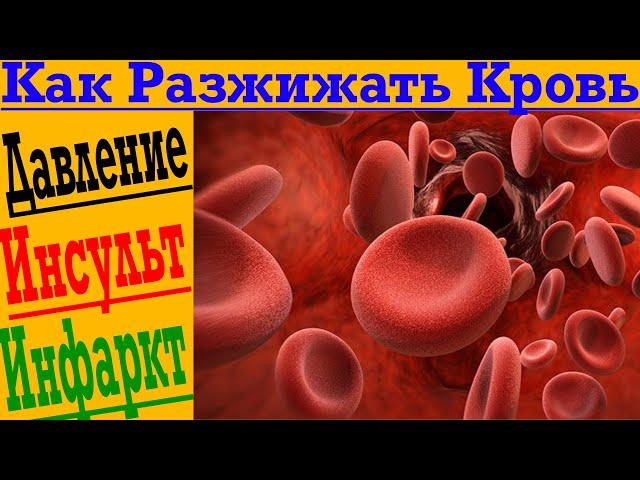 Как разжижать кровь и понизить давление?! Риск инфаркта и инсульта!