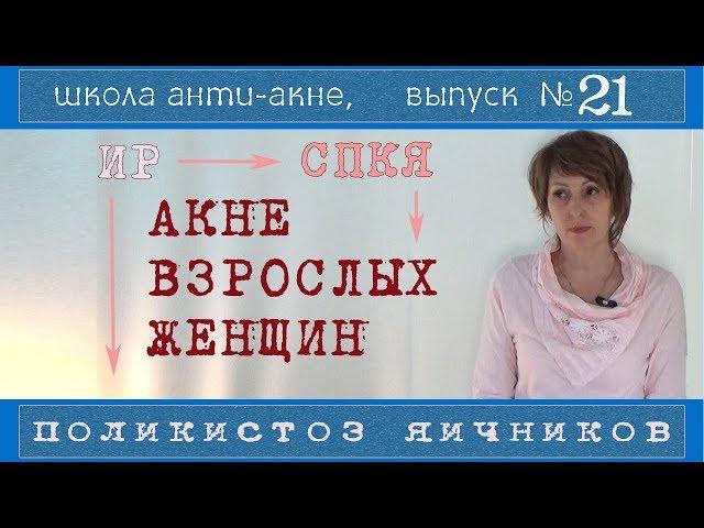 87| Акне и СПКЯ (поликистоз яичников) | Инсулинорезистентность | Можно обойтись без КОКов?