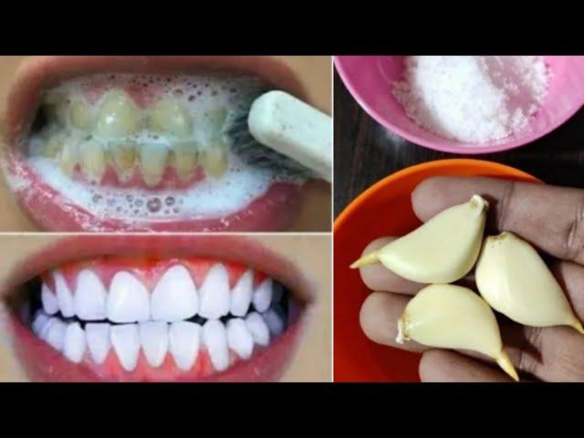 Teeth whitening at home in 2 minutes ||  How to naturally whiten your yellow teeth || 100% effective