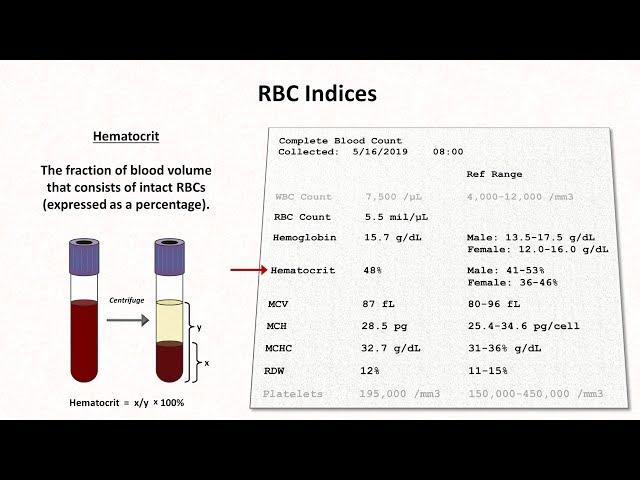 How to Interpret RBC Indices (e.g. hemoglobin vs. hematocrit, MCV, RDW)