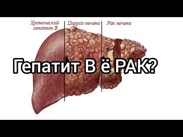 Гепатит В ё Бемории РАК? Саволхои муфид#докторрекомендует