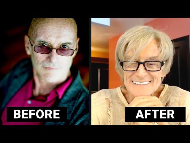 WHY DOES KEN WILBER WEAR A WIG?