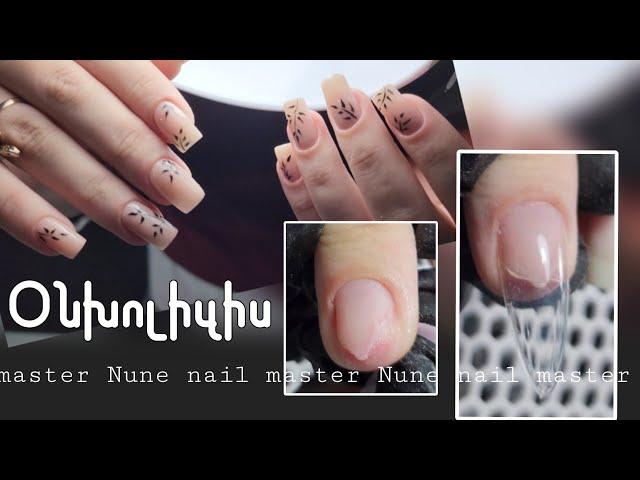 Օնիխոլիզիս և  գարնանային դիզայն _ Nune nail master ️