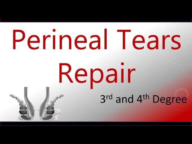 Perineal Tears Repair (Third and Fourth Degree) | TOACS / OSCE Station