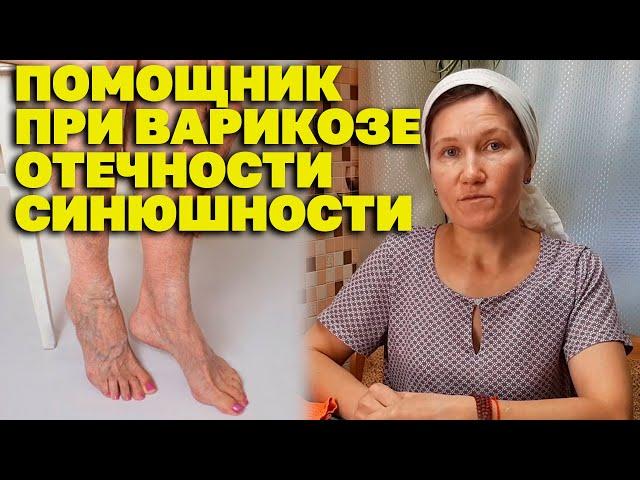 МОЩНОЕ СРЕДСТВО ОТ БОЛИ В НОГАХ ЭФФЕКТИВНОЕ ЛЕЧЕНИЕ ВАРИКОЗА  @natureMarusya