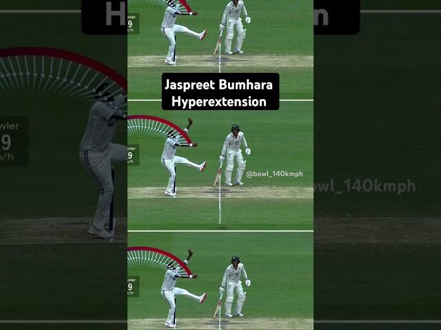 Jaspreet Bumhara uses more pace with Hyperextension in his bowling action #fastbowling#cricket#