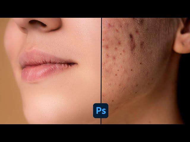 Photoshop High End Skin Retouching || Face Retouching || DK ARNIYA