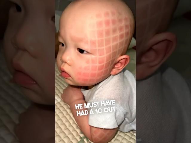 This baby looked completely different after a nap 