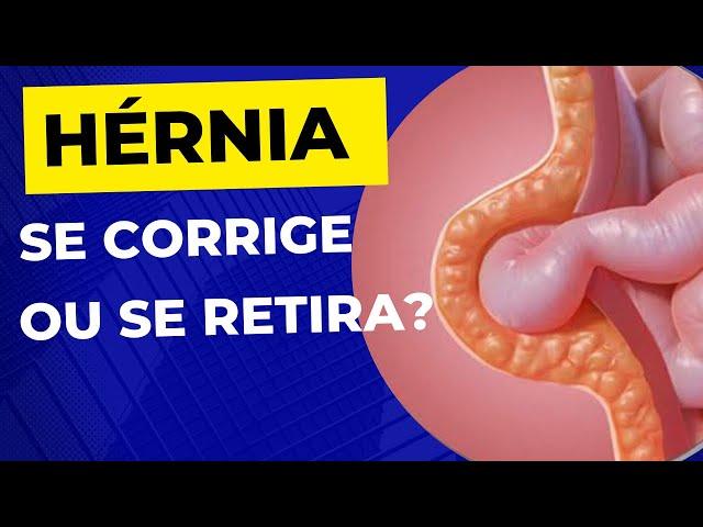 Como é a CIRURGIA DE HÉRNIA? A hérnia é retirada ?