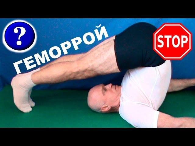 How to cure hemorrhoids without drugs and operations | Hemorrhoids Treatment | AS?