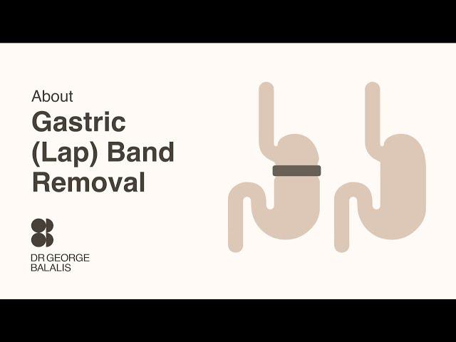 Dr George Balalis | About Gastric (Lap) Band removal surgery