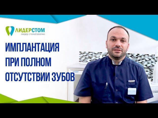 Имплантация зубов при полном отсутствии зубов.  Полная имплантация зубов.