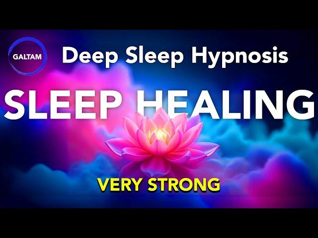 Deep Sleep Hypnosis  (Fast Healing) VERY POWERFUL!! Healing Sleep