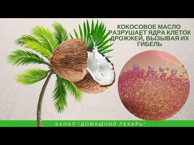 Как вылечить молочницу за 1 месяц? Кокосовое масло - Домашний лекарь - выпуск №245