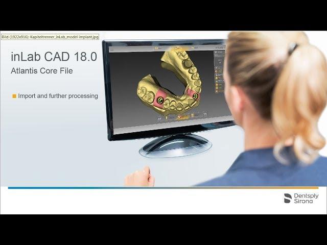 inLab CAD 18.0 Import and further processing of an Atlantis Core File (en)