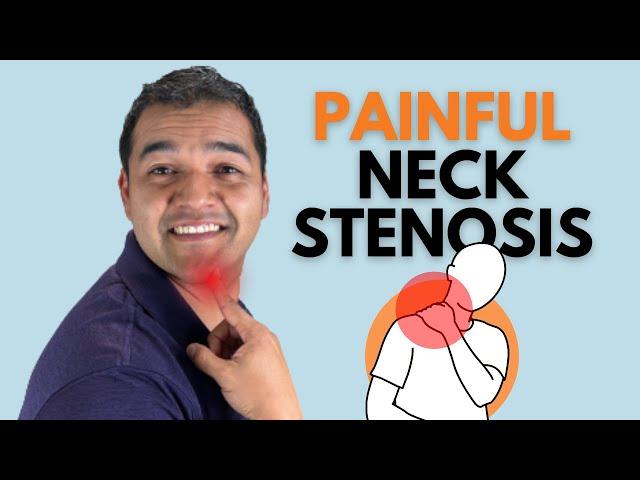 What Actually Causes Painful Neck Cervical Stenosis?