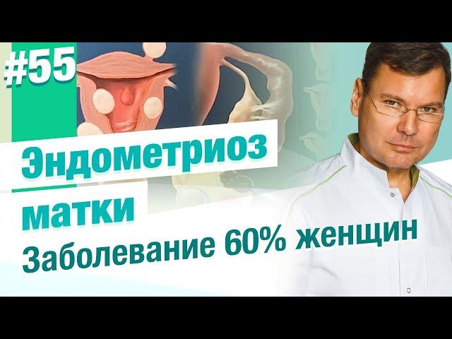 Что такое эндометриоз матки?