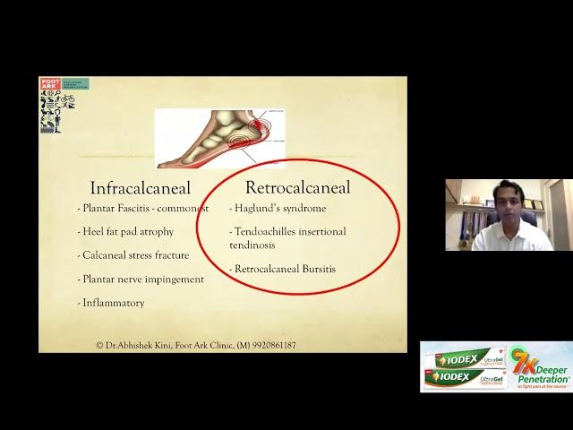 OrthoTV Original - Pain in the Heel - Management Options - Dr Abhishek Kini