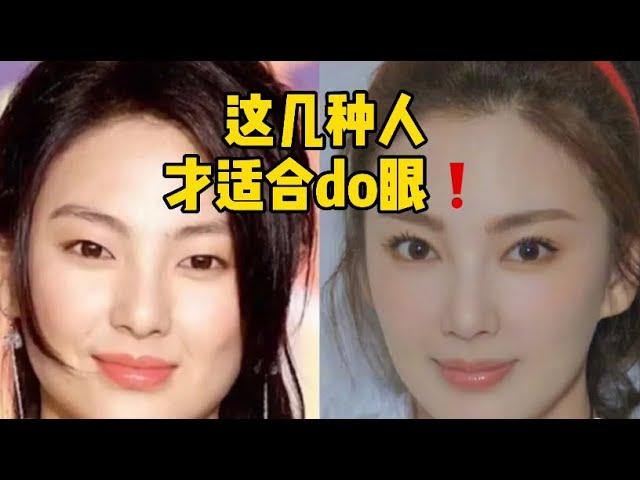 【韩国整形】想做双眼皮？！先看看你适不适合！