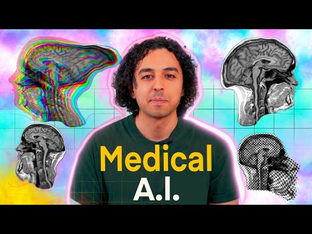 How AI Changed MRI Forever